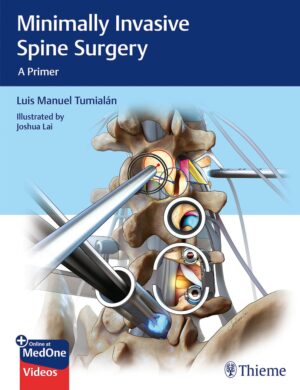 Minimally Invasive Spine Surgery: A Primer With Videos